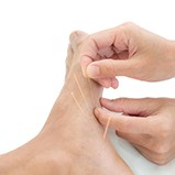 patient’s foot with dry needles in it
