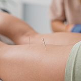 dry needling on a patient’s back of the leg
